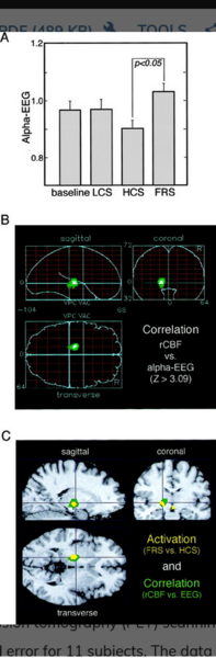 Screenshot 2024-06-24 at 16-45-46 Inaudible High-Frequency Sounds Affect Brain Activity Hypersonic Effect Journal of Neurophysiology.png